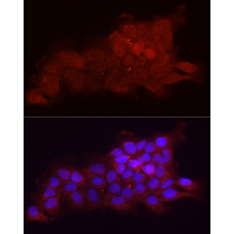 Immunofluorescence - Anti-Fbx32 Antibody (A80674) - Antibodies.com