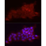 Immunofluorescence - Anti-Fbx32 Antibody (A80674) - Antibodies.com
