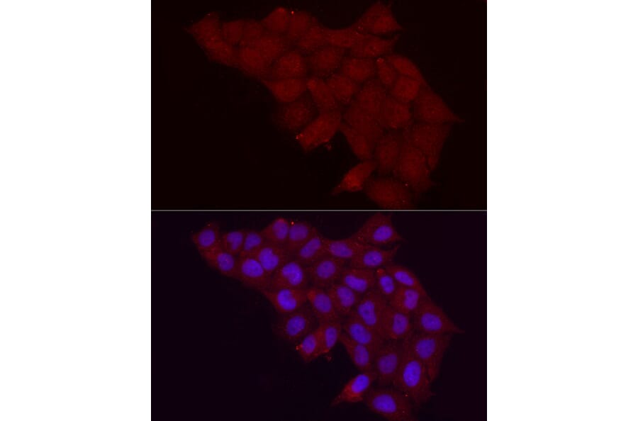 Immunofluorescence - Anti-Fbx32 Antibody (A80674) - Antibodies.com