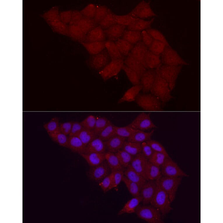 Immunofluorescence - Anti-Fbx32 Antibody (A80674) - Antibodies.com