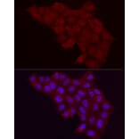 Immunofluorescence - Anti-Fbx32 Antibody (A80674) - Antibodies.com