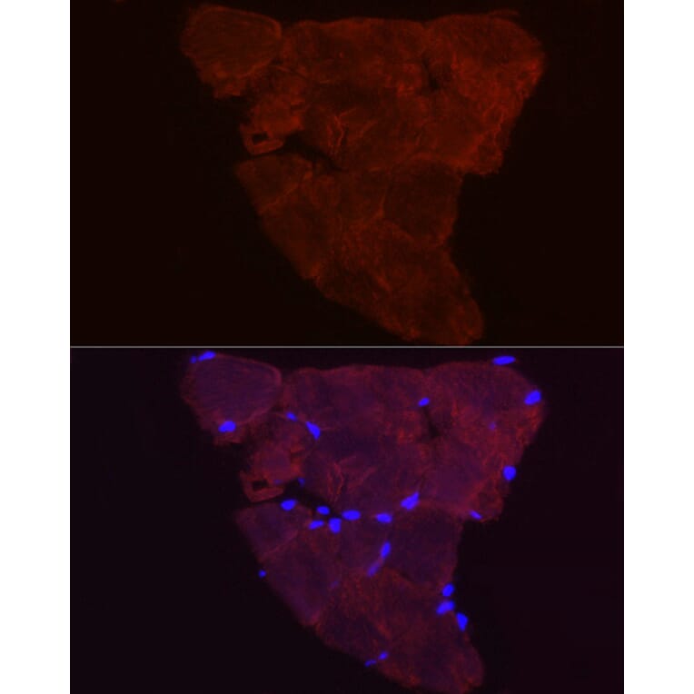 Immunofluorescence - Anti-Fbx32 Antibody (A80674) - Antibodies.com