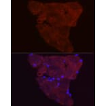 Immunofluorescence - Anti-Fbx32 Antibody (A80674) - Antibodies.com