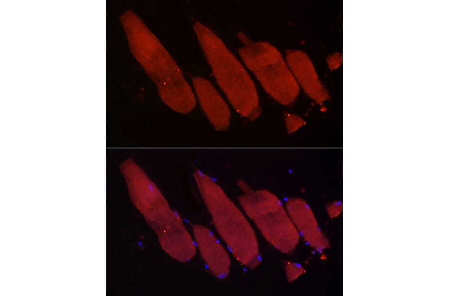 Immunofluorescence - Anti-Fbx32 Antibody (A80674) - Antibodies.com