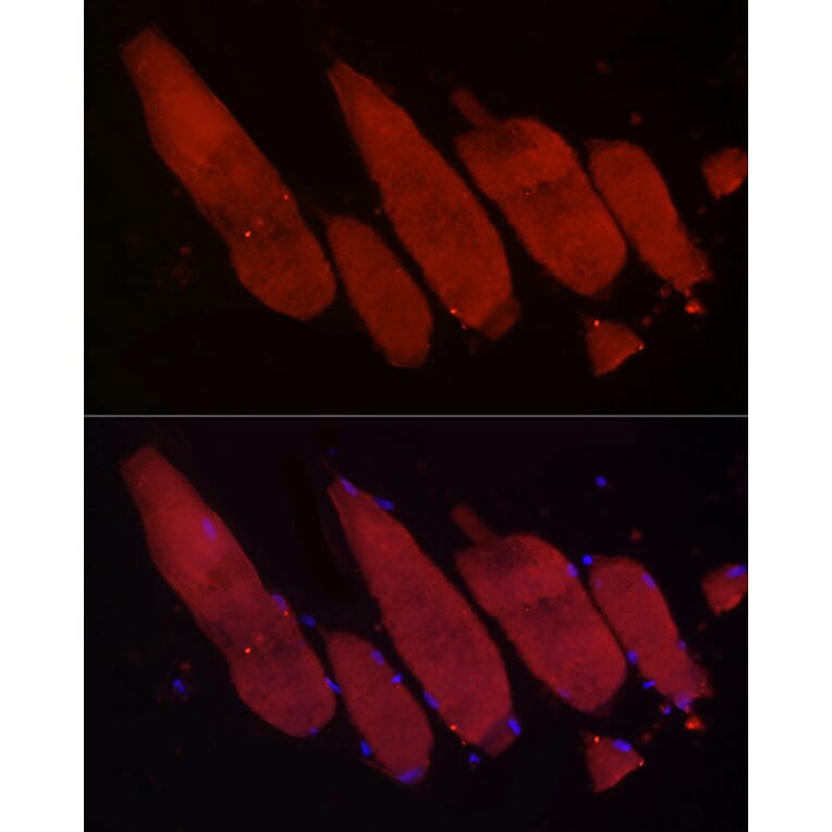 Immunofluorescence - Anti-Fbx32 Antibody (A80674) - Antibodies.com