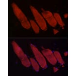 Immunofluorescence - Anti-Fbx32 Antibody (A80674) - Antibodies.com