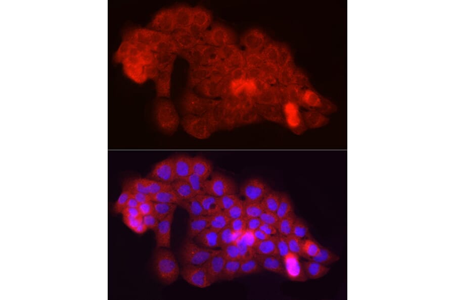 Immunofluorescence - Anti-Fbx32 Antibody (A80674) - Antibodies.com