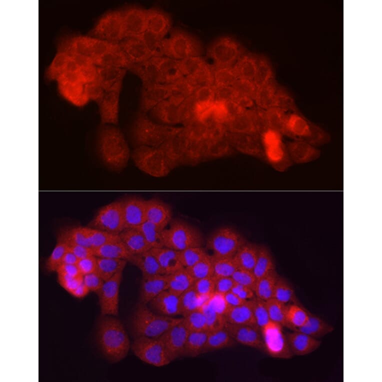 Immunofluorescence - Anti-Fbx32 Antibody (A80674) - Antibodies.com