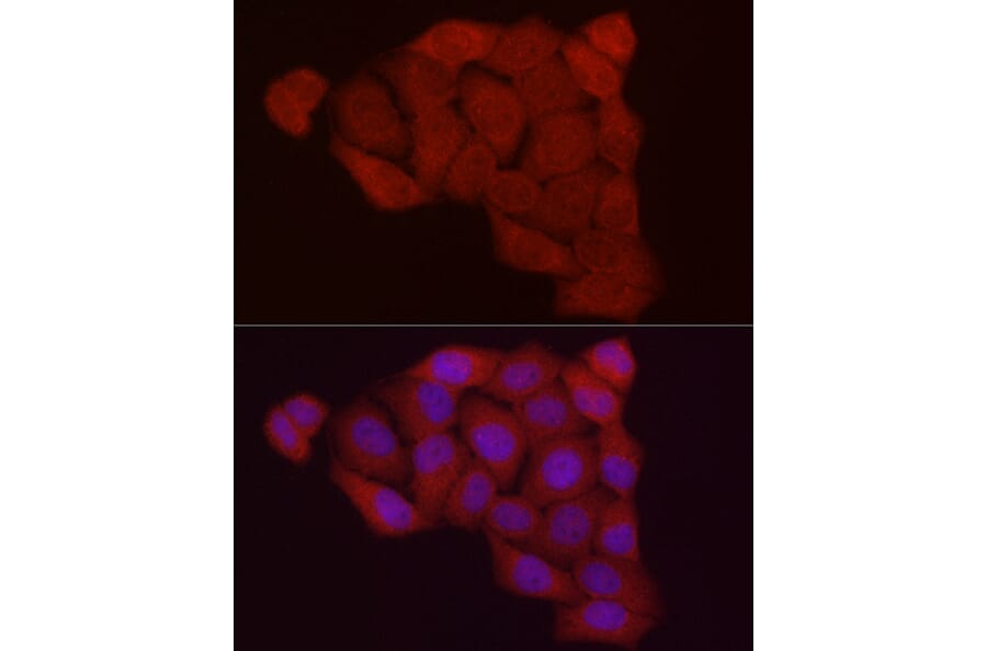 Immunofluorescence - Anti-Fbx32 Antibody (A80674) - Antibodies.com