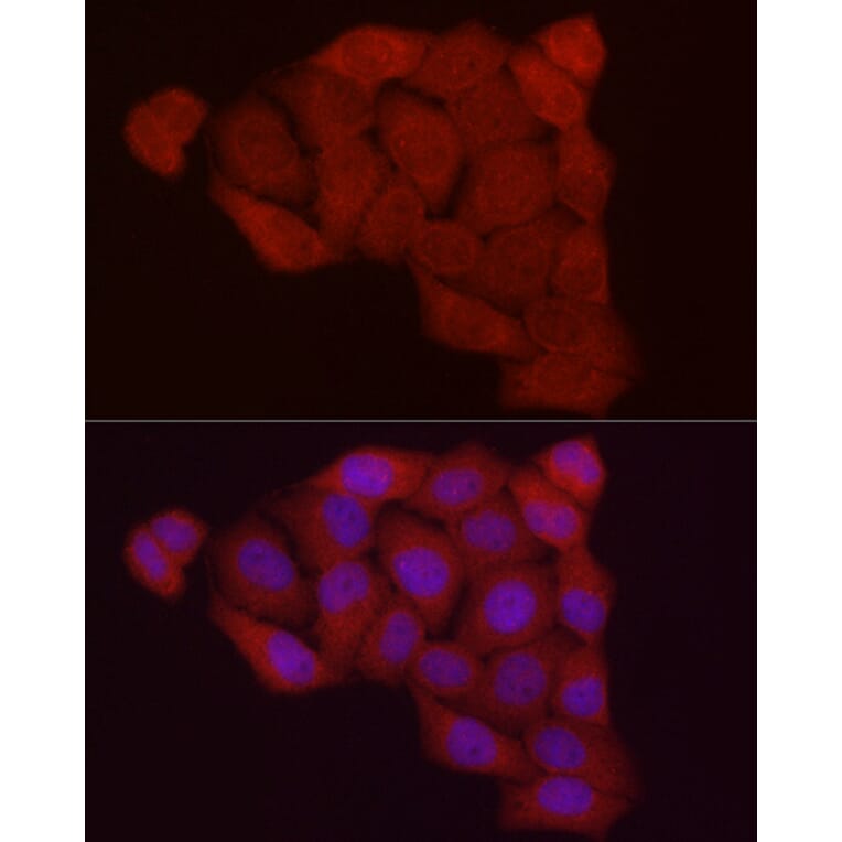 Immunofluorescence - Anti-Fbx32 Antibody (A80674) - Antibodies.com