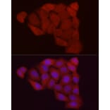 Immunofluorescence - Anti-Fbx32 Antibody (A80674) - Antibodies.com