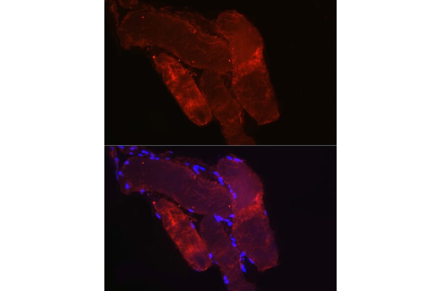 Immunofluorescence - Anti-Fbx32 Antibody (A80674) - Antibodies.com