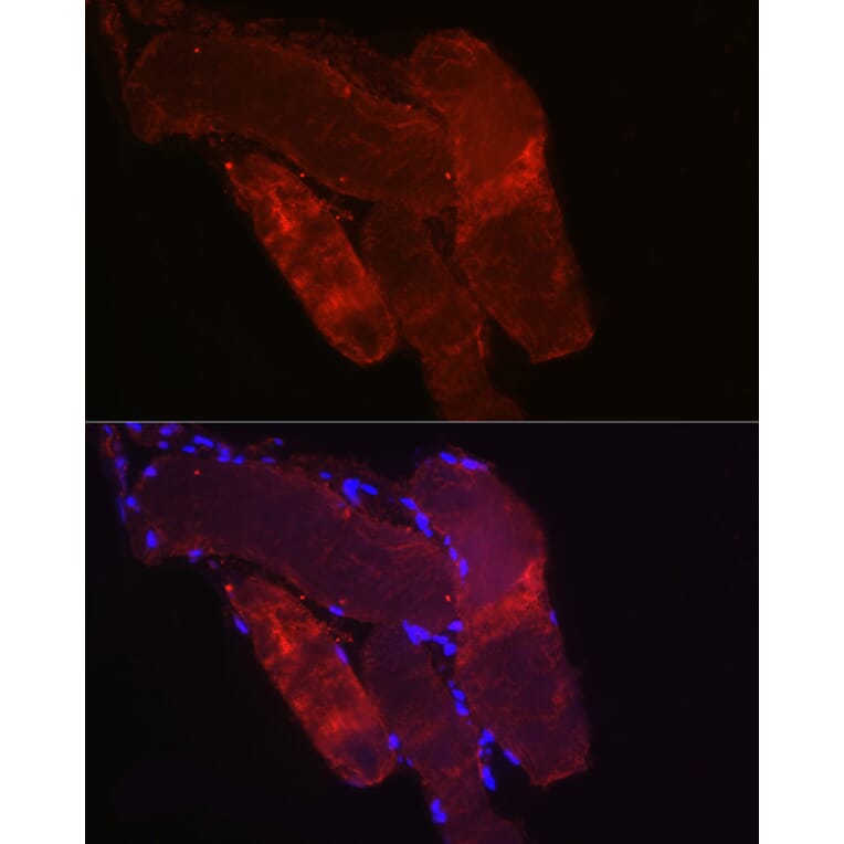 Immunofluorescence - Anti-Fbx32 Antibody (A80674) - Antibodies.com