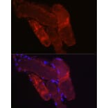 Immunofluorescence - Anti-Fbx32 Antibody (A80674) - Antibodies.com