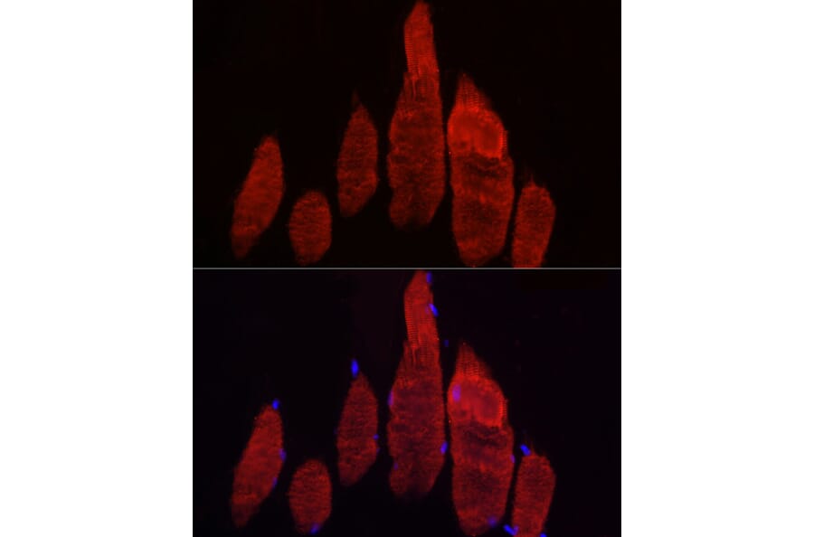 Immunofluorescence - Anti-Fbx32 Antibody (A80674) - Antibodies.com