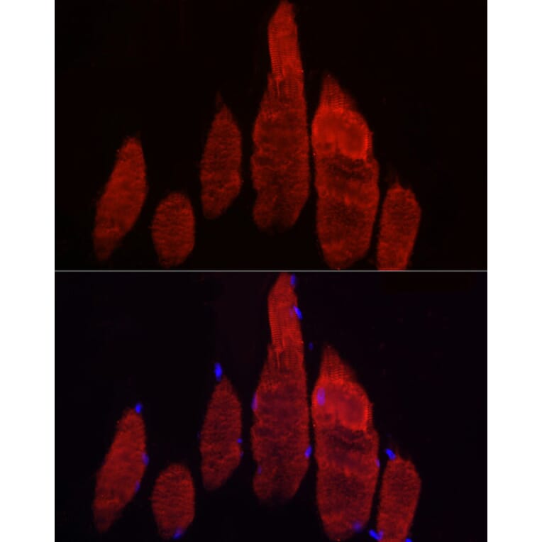 Immunofluorescence - Anti-Fbx32 Antibody (A80674) - Antibodies.com