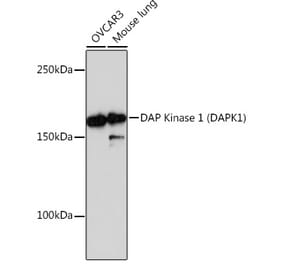 Western Blot - Anti-DAP Kinase 1 Antibody [ARC0601] (A80676) - Antibodies.com