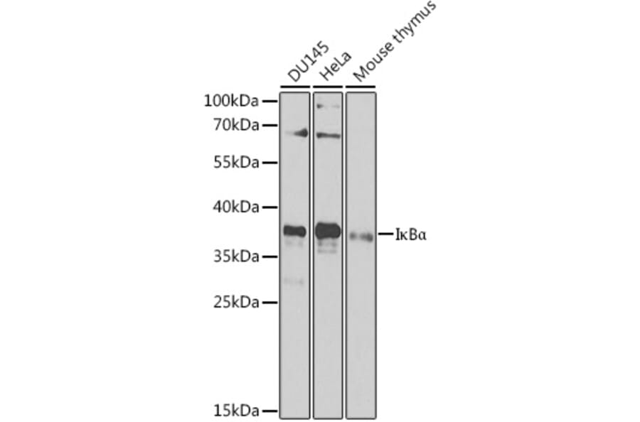 Western Blot - Anti-IKB alpha Antibody (A80677) - Antibodies.com