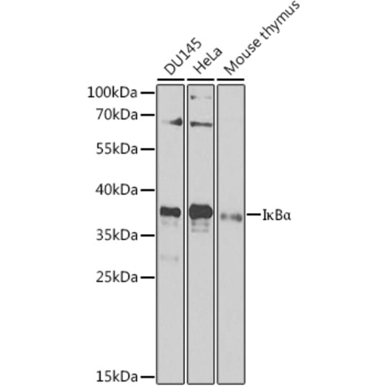 Western Blot - Anti-IKB alpha Antibody (A80677) - Antibodies.com