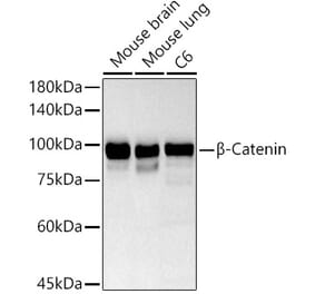 Western Blot - Anti-beta Catenin Antibody (A80679) - Antibodies.com