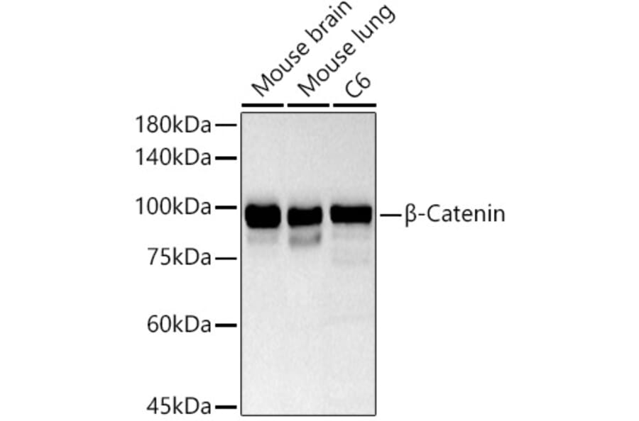 Western Blot - Anti-beta Catenin Antibody (A80679) - Antibodies.com
