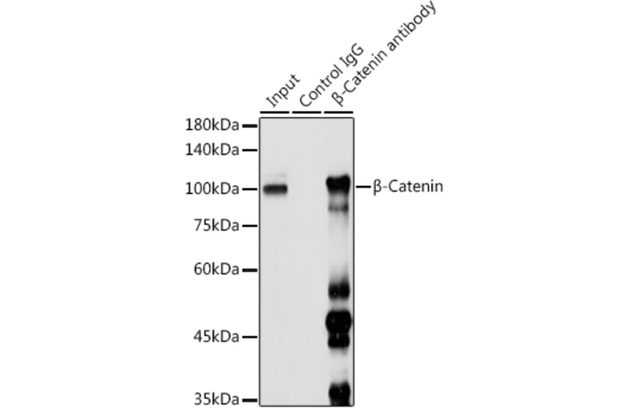 Western Blot - Anti-beta Catenin Antibody (A80679) - Antibodies.com