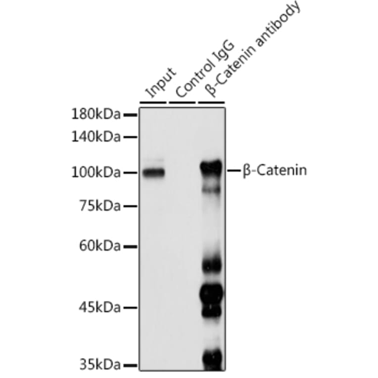 Western Blot - Anti-beta Catenin Antibody (A80679) - Antibodies.com
