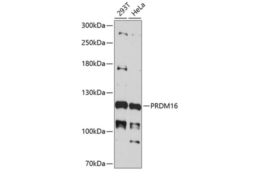 Western Blot - Anti-PRDM16 Antibody (A11581) - Antibodies.com