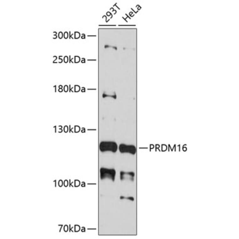 Western Blot - Anti-PRDM16 Antibody (A11581) - Antibodies.com