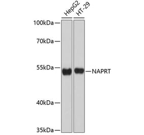 Western Blot - Anti-NAPRT1 Antibody (A80684) - Antibodies.com