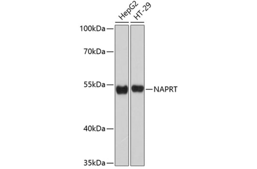 Western Blot - Anti-NAPRT1 Antibody (A80684) - Antibodies.com