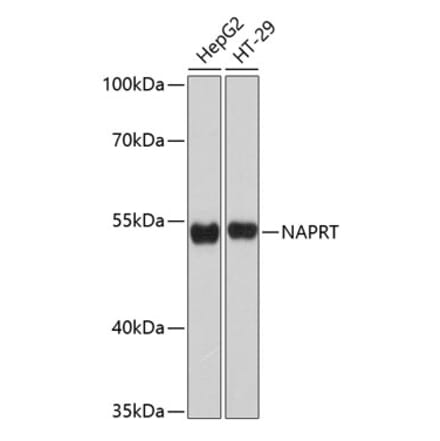 Western Blot - Anti-NAPRT1 Antibody (A80684) - Antibodies.com