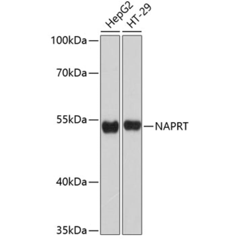 Western Blot - Anti-NAPRT1 Antibody (A80684) - Antibodies.com