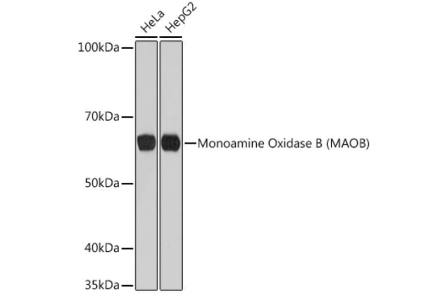 Western Blot - Anti-Monoamine Oxidase B/MAOB Antibody [ARC0641] (A80685) - Antibodies.com