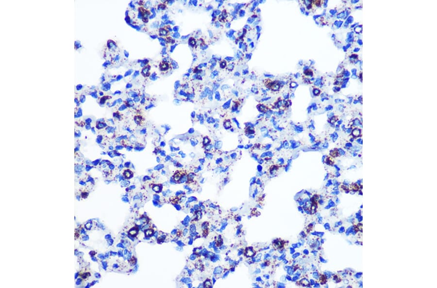 Immunohistochemistry - Anti-Monoamine Oxidase B/MAOB Antibody [ARC0641] (A80685) - Antibodies.com