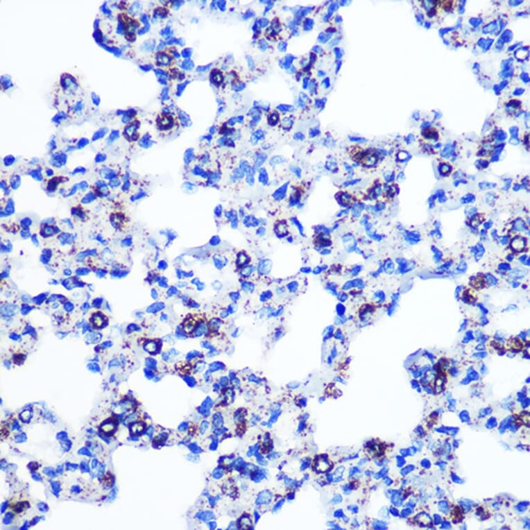 Immunohistochemistry - Anti-Monoamine Oxidase B/MAOB Antibody [ARC0641] (A80685) - Antibodies.com