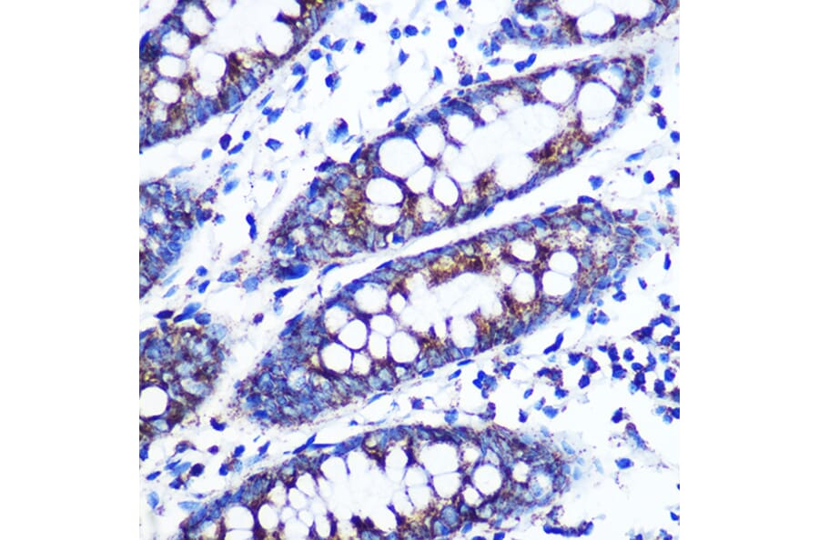Immunohistochemistry - Anti-Monoamine Oxidase B/MAOB Antibody [ARC0641] (A80685) - Antibodies.com