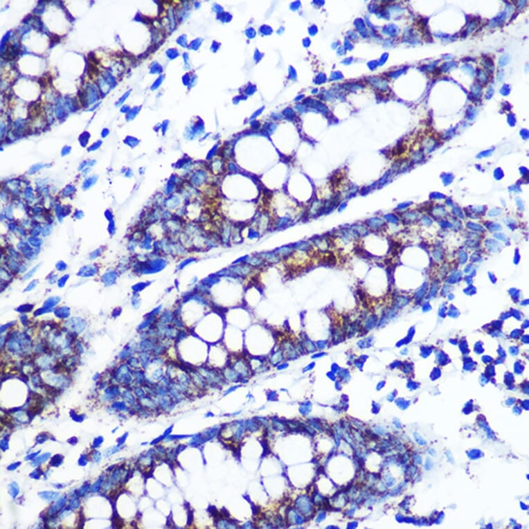 Immunohistochemistry - Anti-Monoamine Oxidase B/MAOB Antibody [ARC0641] (A80685) - Antibodies.com