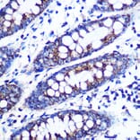 Immunohistochemistry - Anti-Monoamine Oxidase B/MAOB Antibody [ARC0641] (A80685) - Antibodies.com