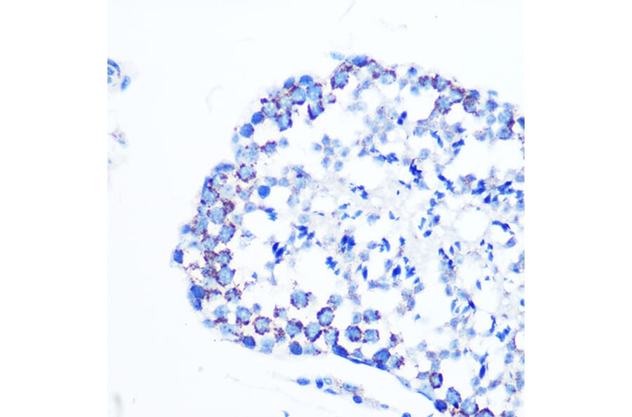 Immunohistochemistry - Anti-Monoamine Oxidase B/MAOB Antibody [ARC0641] (A80685) - Antibodies.com