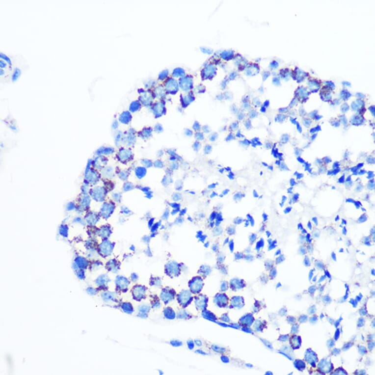 Immunohistochemistry - Anti-Monoamine Oxidase B/MAOB Antibody [ARC0641] (A80685) - Antibodies.com