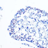 Immunohistochemistry - Anti-Monoamine Oxidase B/MAOB Antibody [ARC0641] (A80685) - Antibodies.com