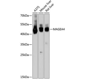 Western Blot - Anti-MAGEA4 Antibody (A80687) - Antibodies.com