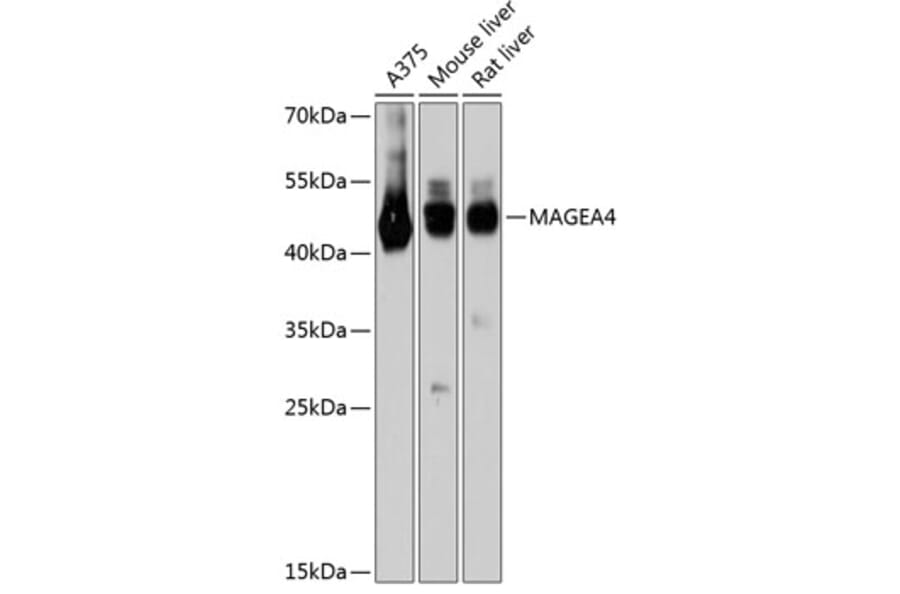 Western Blot - Anti-MAGEA4 Antibody (A80687) - Antibodies.com