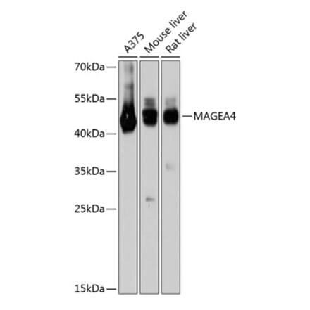 Western Blot - Anti-MAGEA4 Antibody (A80687) - Antibodies.com