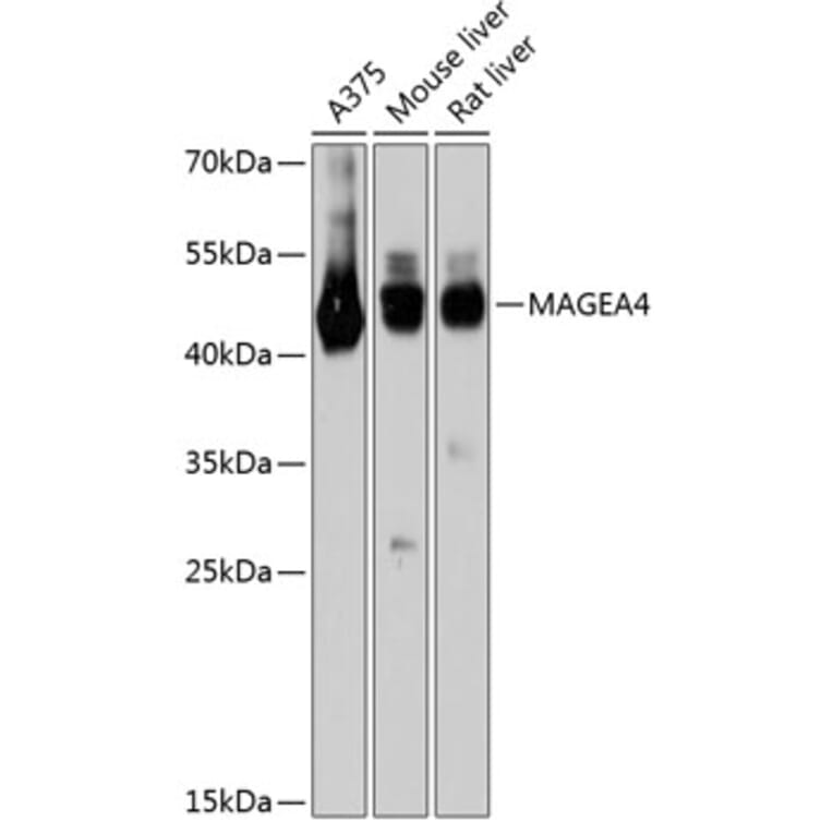 Western Blot - Anti-MAGEA4 Antibody (A80687) - Antibodies.com