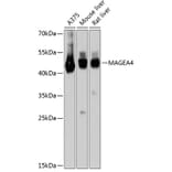 Western Blot - Anti-MAGEA4 Antibody (A80687) - Antibodies.com