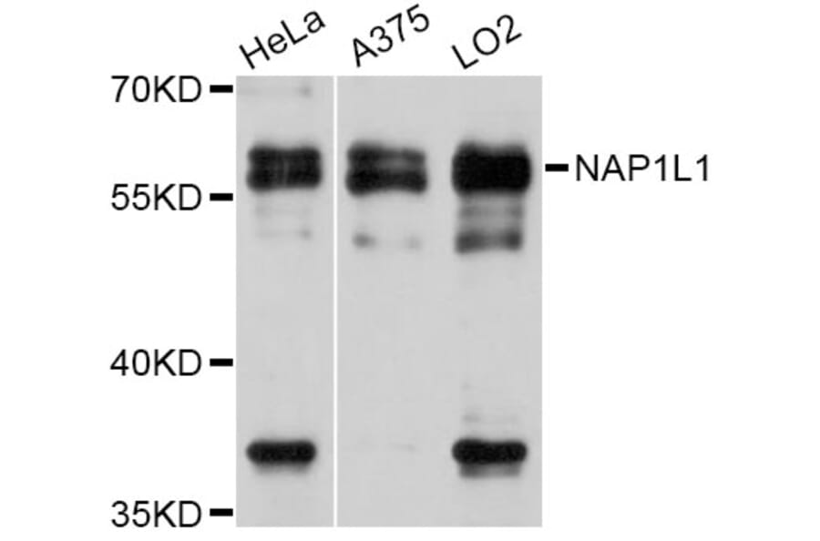 Western Blot - Anti-NAP1L1 Antibody (A11610) - Antibodies.com