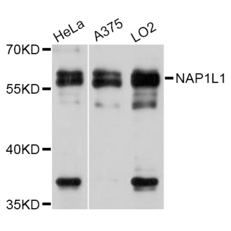 Western Blot - Anti-NAP1L1 Antibody (A11610) - Antibodies.com