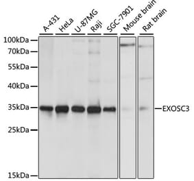 Western Blot - Anti-EXOSC3 Antibody (A80690) - Antibodies.com